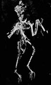 dorsal view of skeleton