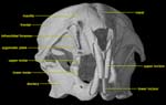 anterior view of skull